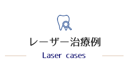 きたいま歯科　レーザー治療の症例紹介